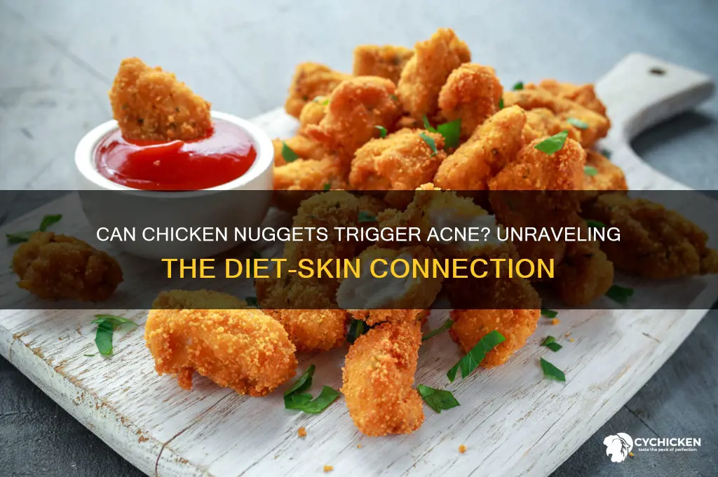 can chicken nuggets cause acne