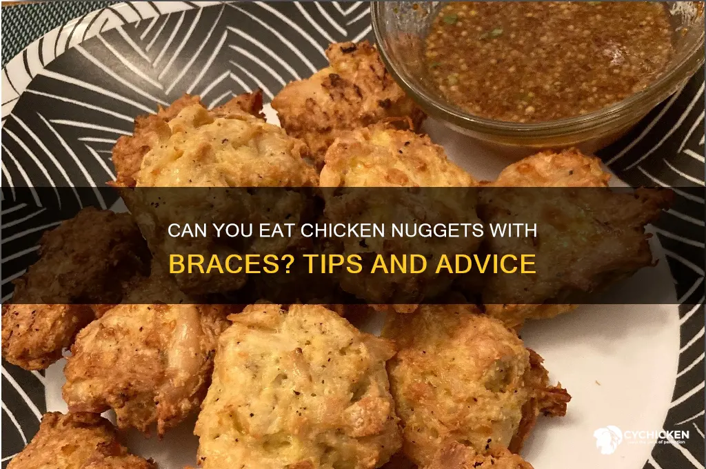 can i have chicken nuggets with braces