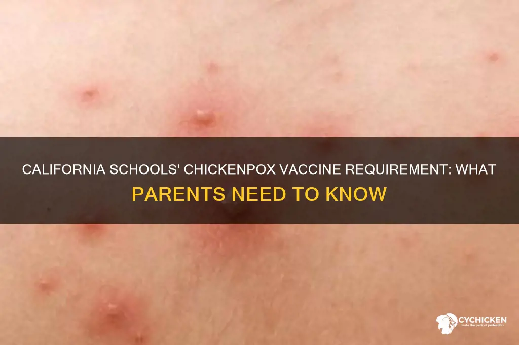 do california schools require chicken chickenpox vaccine