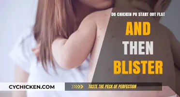 Chicken Pox: Blisters and Flat Spots