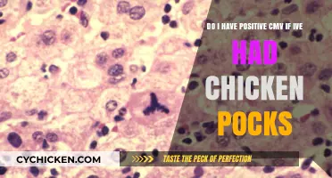 CMV and Chicken Pox: What's the Link?