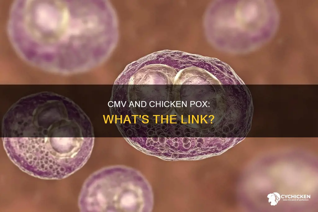 do i have positive cmv if ive had chicken pocks
