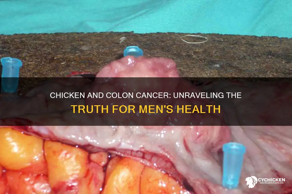 does chicken cause colon cancer in men
