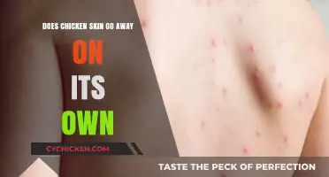 Can Chicken Skin Disappear Naturally? Understanding Keratosis Pilaris Causes and Remedies