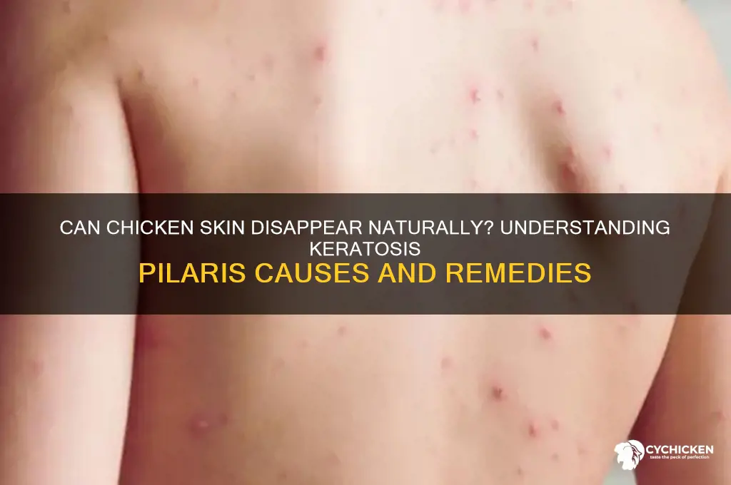 does chicken skin go away on its own