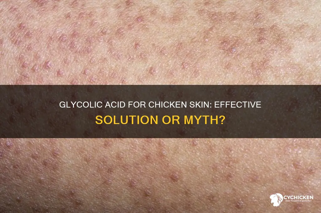 does glycolic acid help with chicken skin