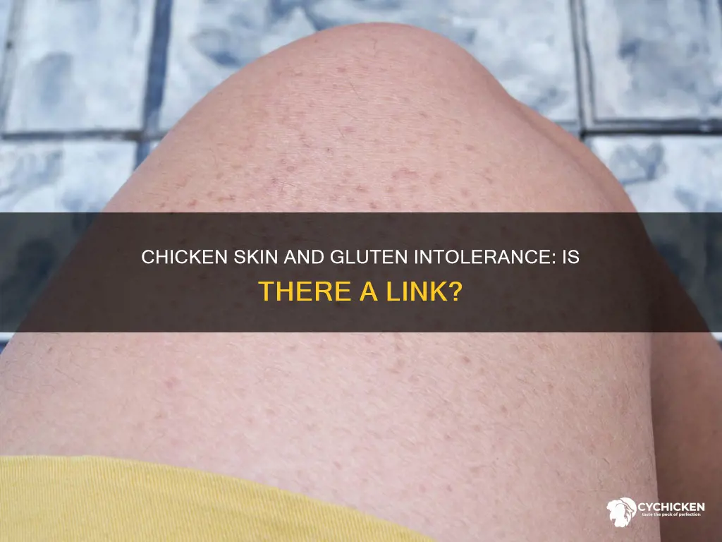 does having chicken skin mean you are intolerant to gluten