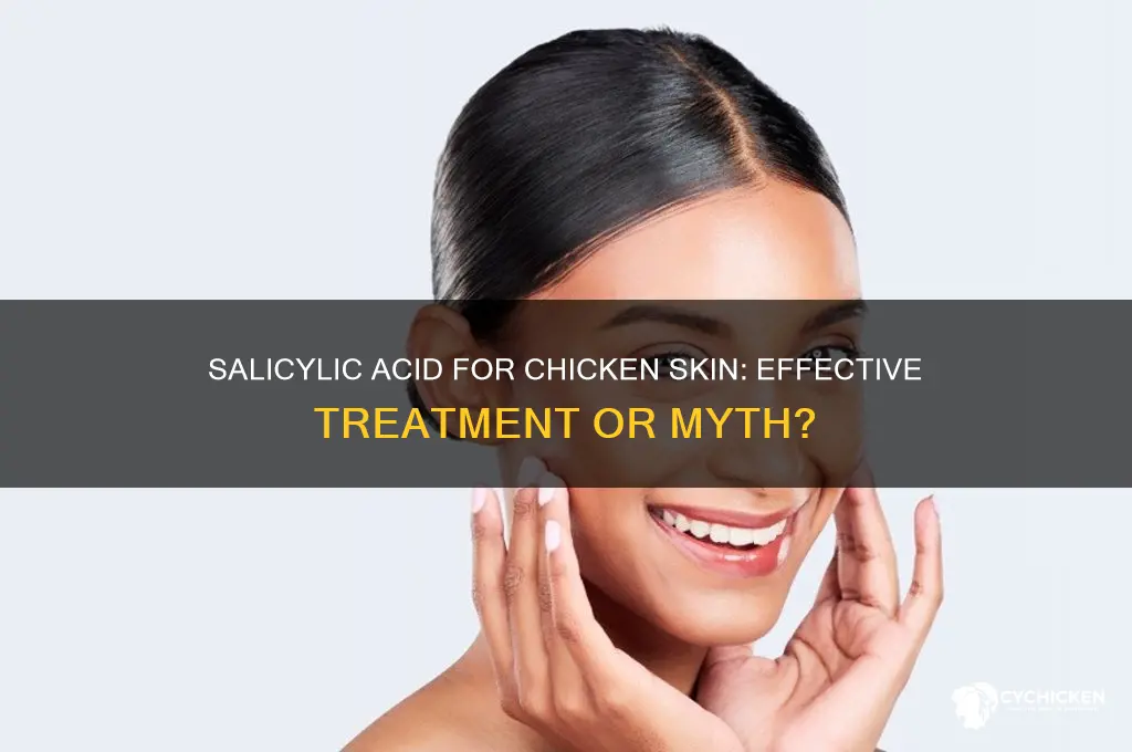 does salicylic acid help with chicken skin