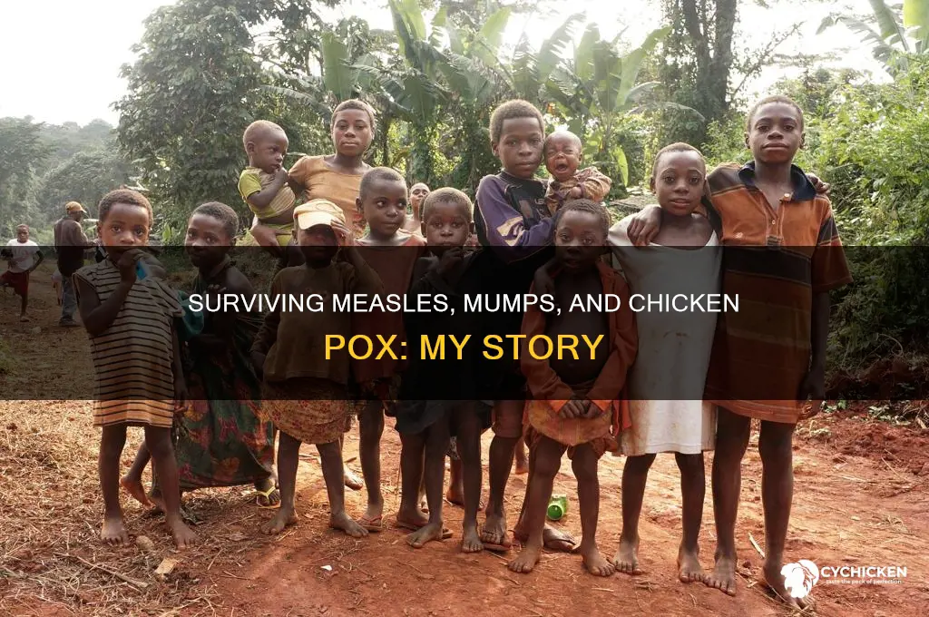 how did i survive measles mumps and chicken pos