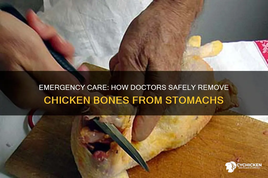 how do dr extract chicken bones from stomachs