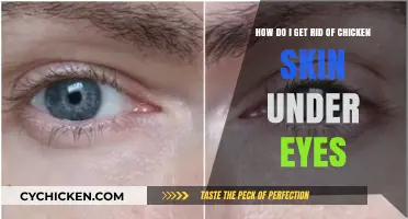 Banish Chicken Skin Under Eyes: A Comprehensive Guide
