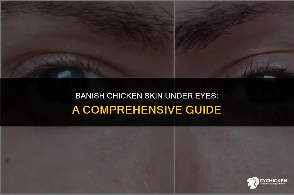 how do i get rid of chicken skin under eyes