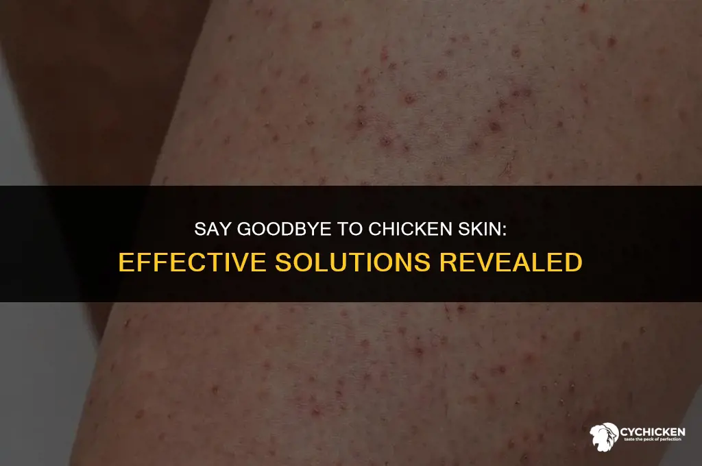 how do i get rid of chicken skin
