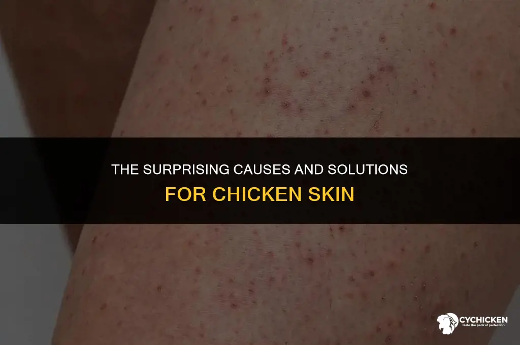 how do you get chicken skin