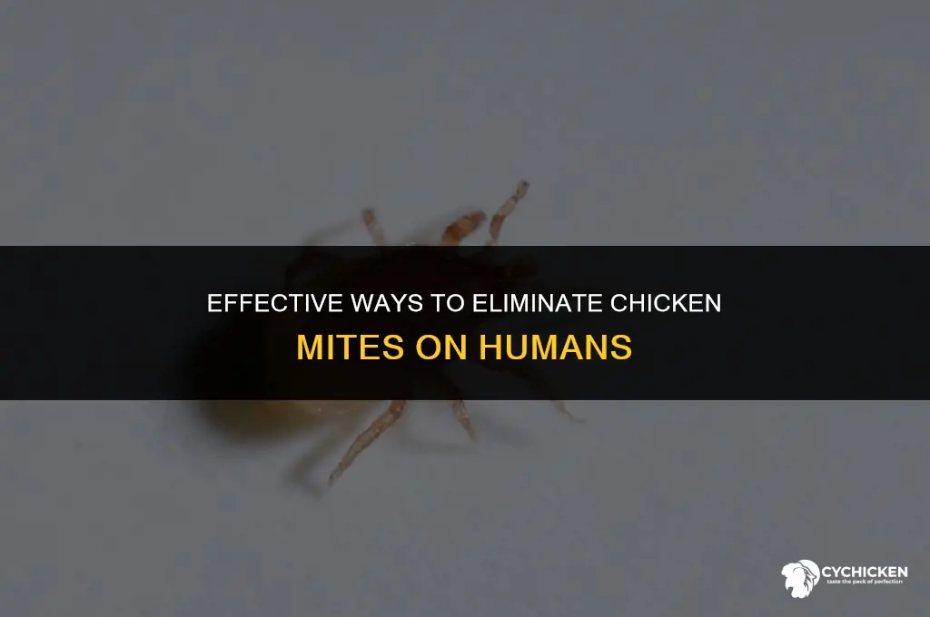 how do you get rid of chicken mites on humans