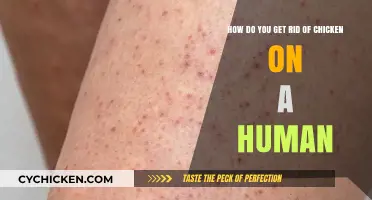 Effective Ways to Remove Chicken from Human Skin