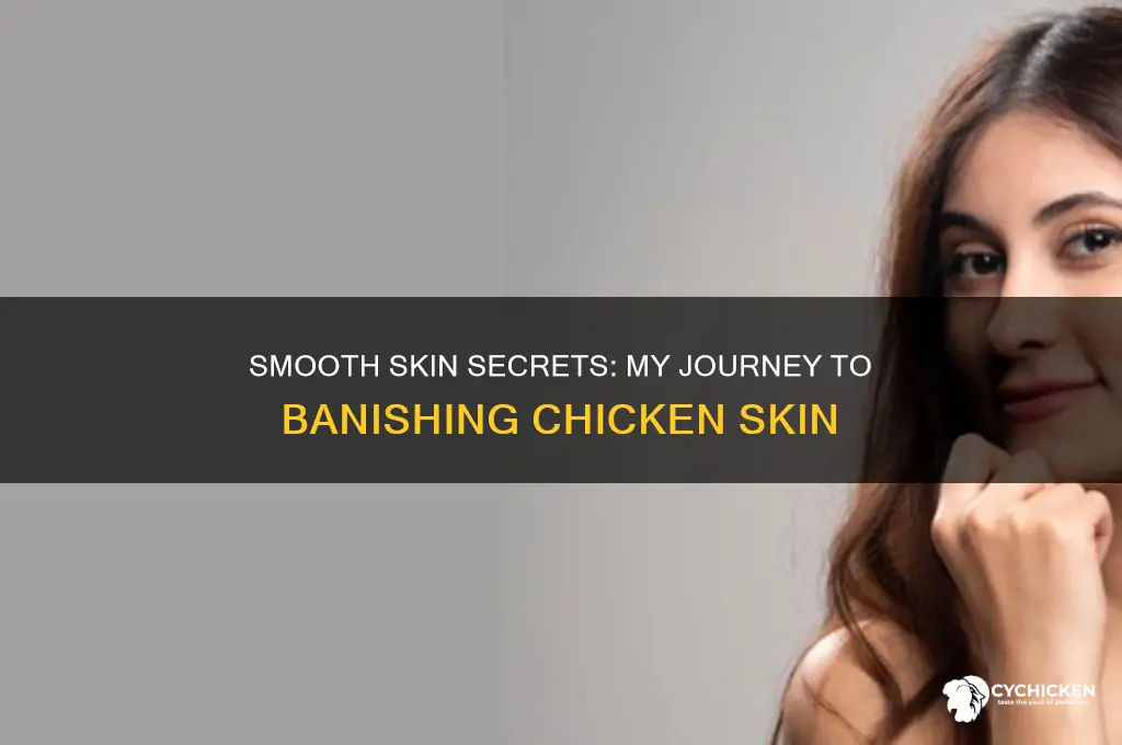 how i got rid of my chicken skin
