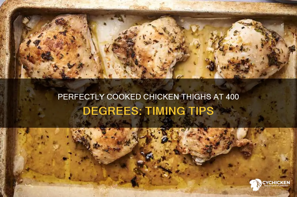 how long chicken thighs 400 degrees