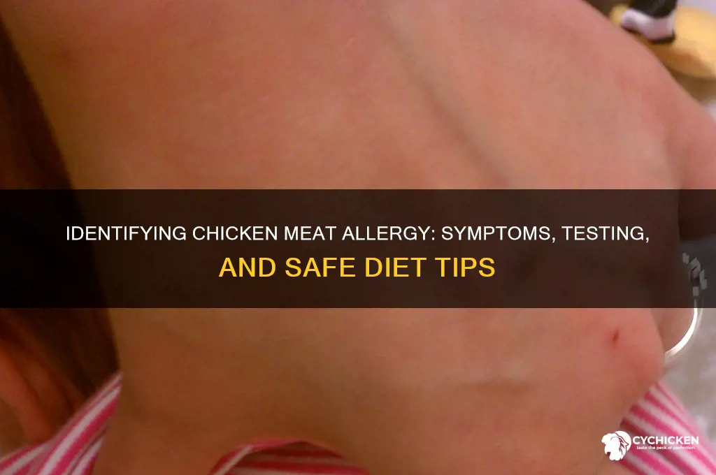 how to check for chicken meat allergy