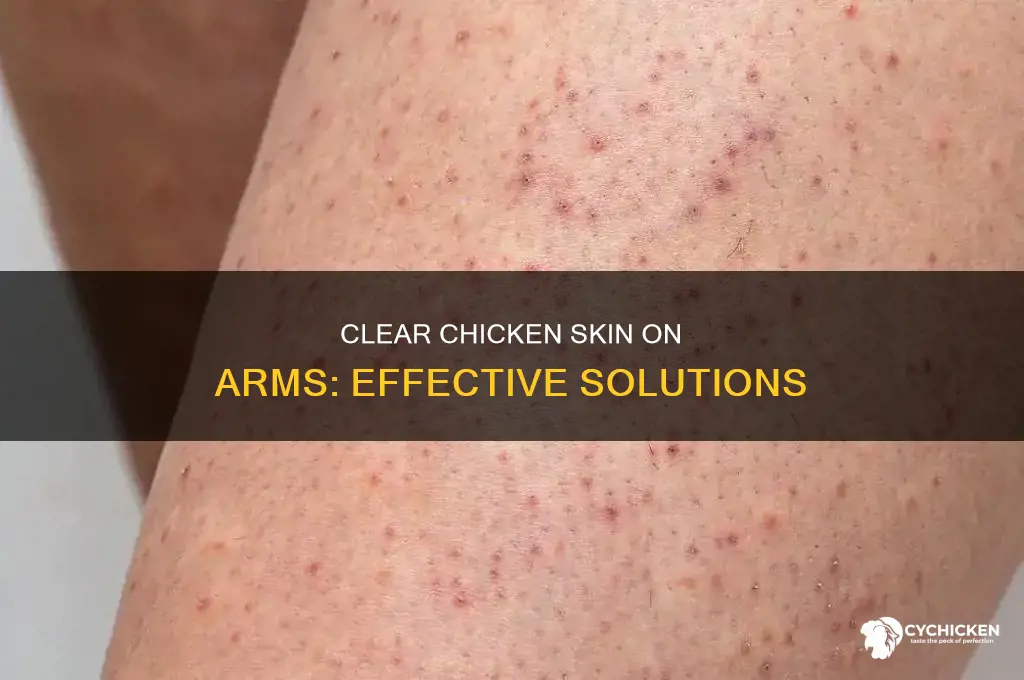 how to clear up chicken skin on arms