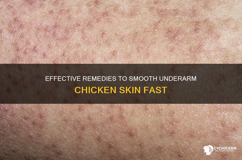 how to cure chicken skin in underarm