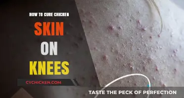 Effective Remedies to Smooth Chicken Skin on Your Knees