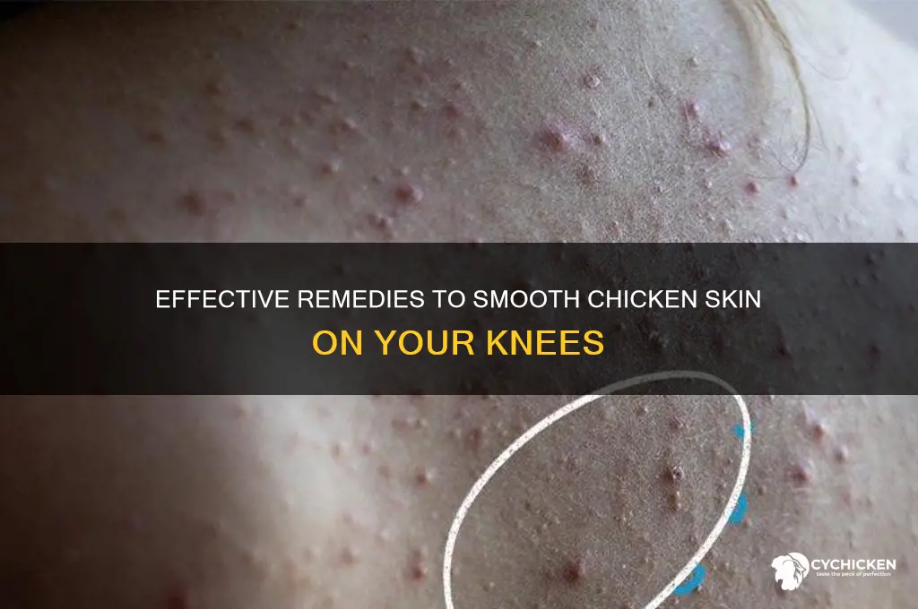 how to cure chicken skin on knees