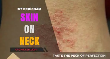 Effective Remedies to Smooth and Heal Chicken Skin on Your Neck
