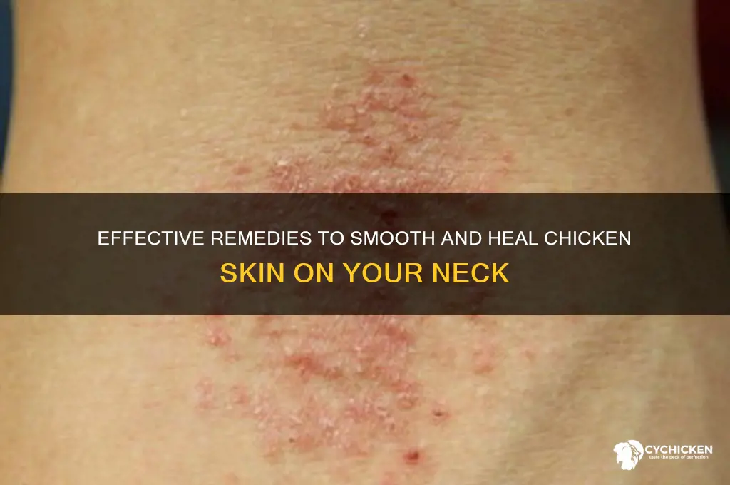 how to cure chicken skin on neck