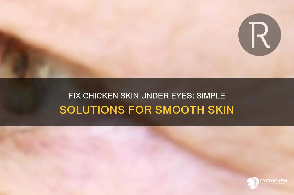 how to fix chicken skin under eyes