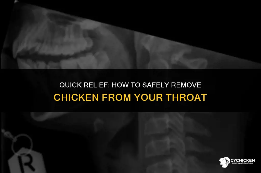 how to get chicken out of your throat