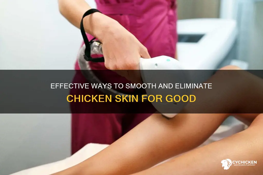 how to gwt rid of chicken skin