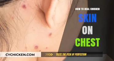 Heal Chicken Skin on Chest: Effective Remedies for Smooth, Clear Skin