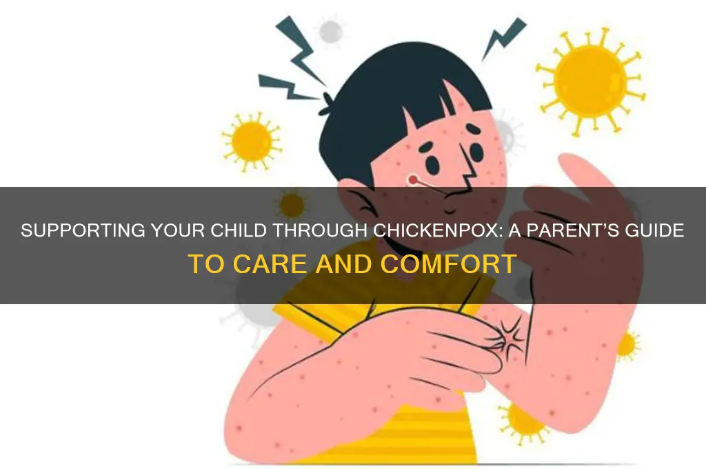 how to help your child contract chicken pos