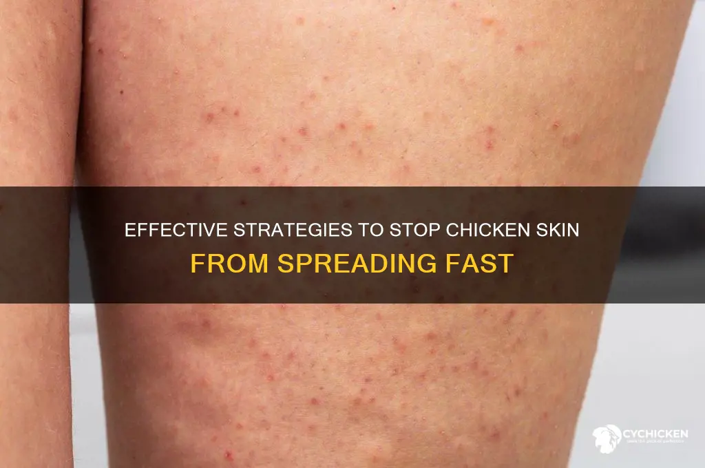 how to prevent chicken skin from spreading