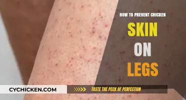 Smooth Legs: Effective Tips to Prevent Chicken Skin (Keratosis Pilaris)