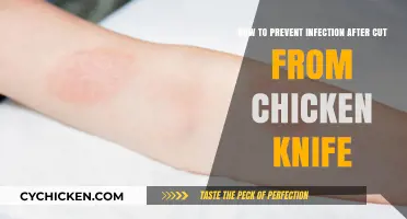 Preventing Infection After a Cut: Chicken Knife Safety