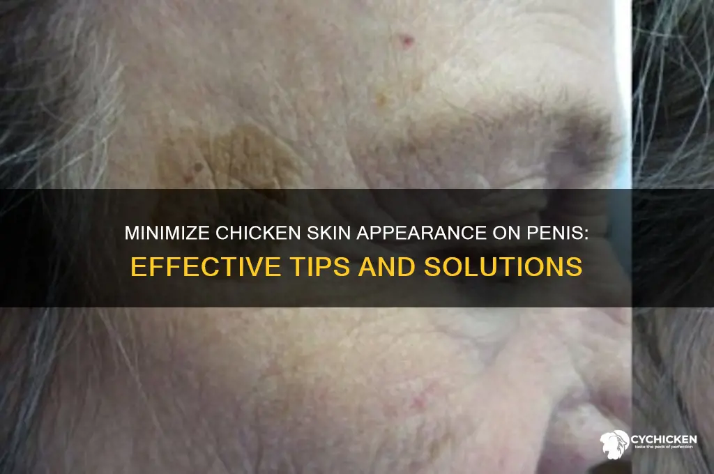 how to reduce chicken skin look on penis