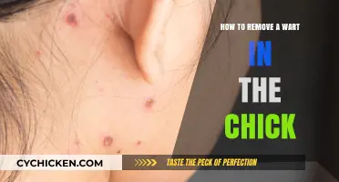 Effective Home Remedies to Safely Remove Warts on Chickens