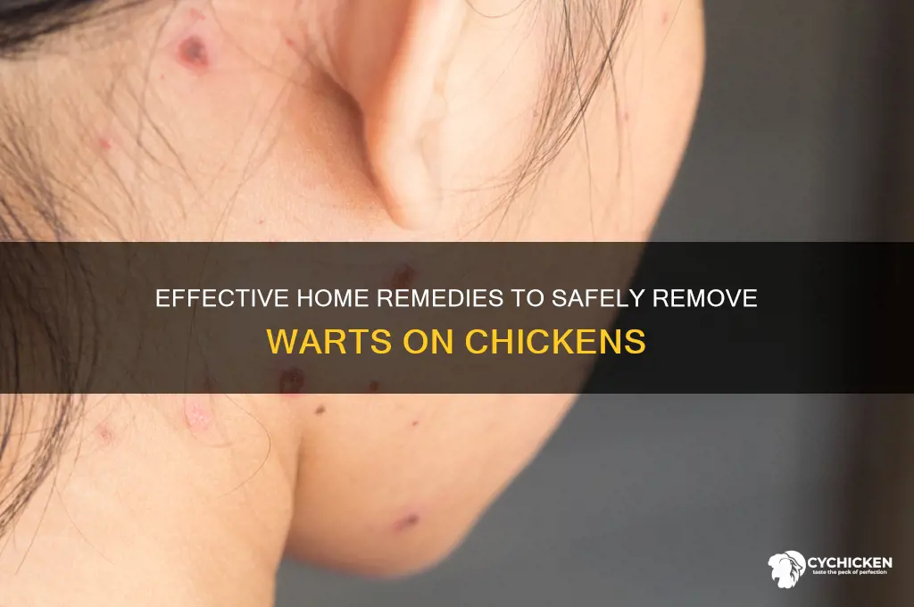 how to remove a wart in the chick