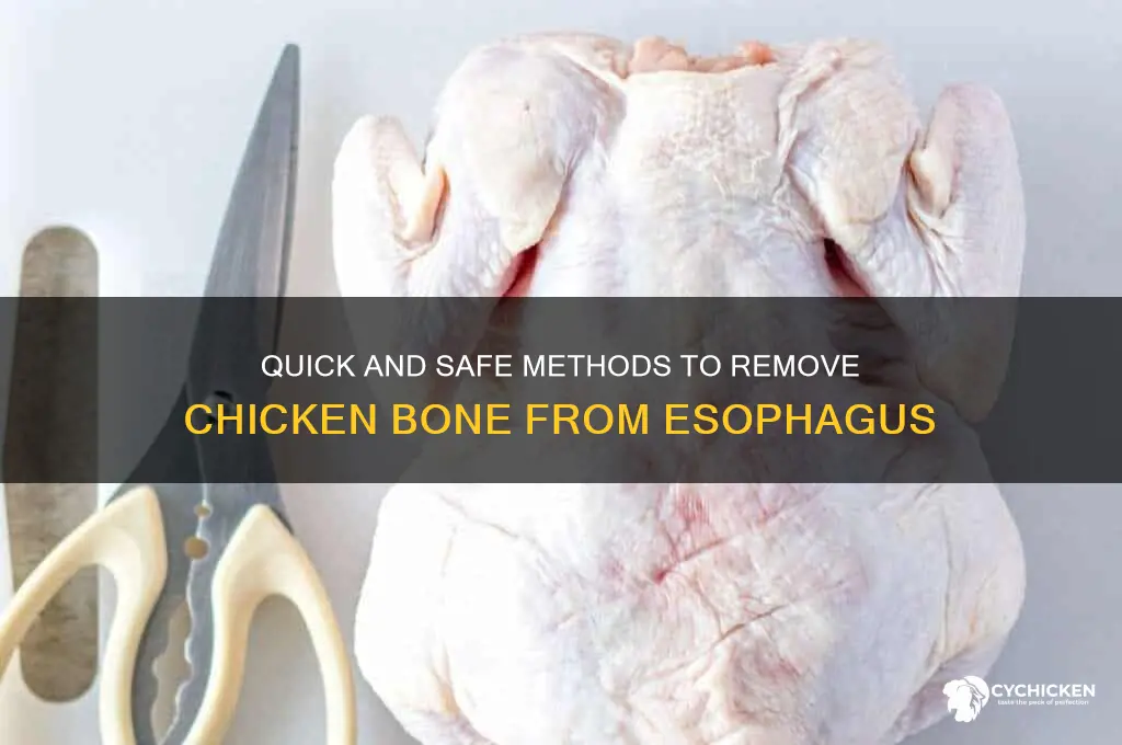 how to remove chicken bone from esophagus