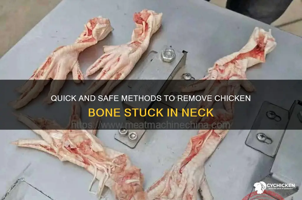 how to remove chicken bone from neck
