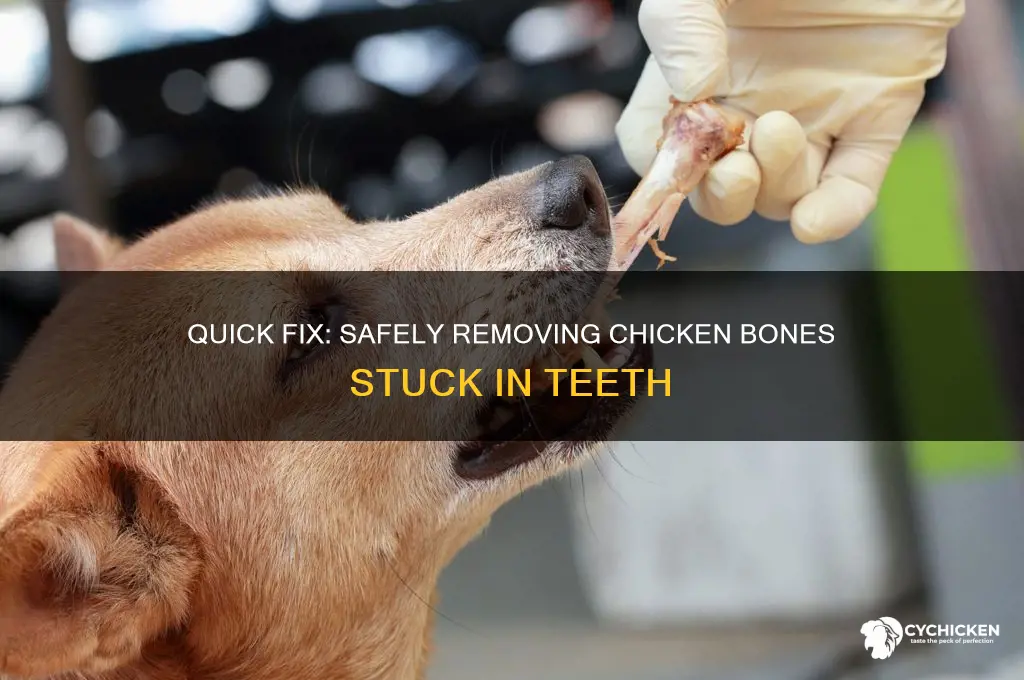 how to remove chicken bone from teeth