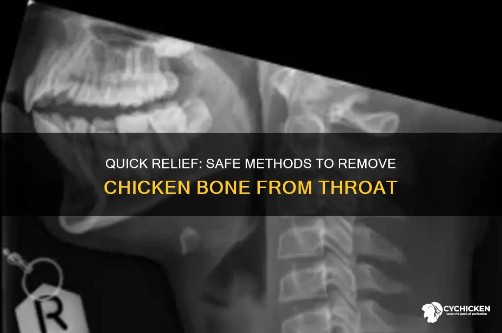 how to remove chicken bone from throat