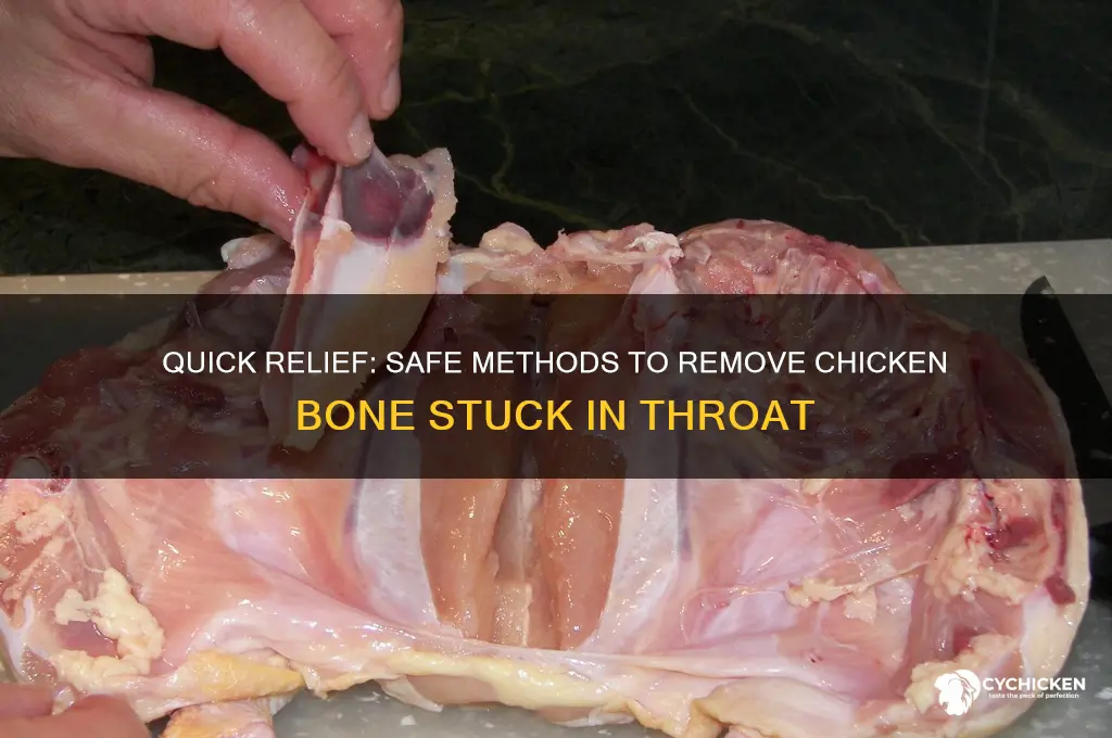 how to remove chicken bone stuck in throat