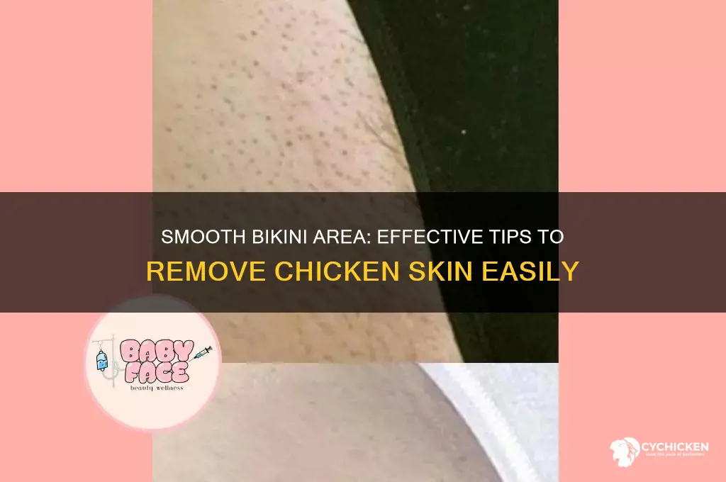 how to remove chicken skin in bikini area