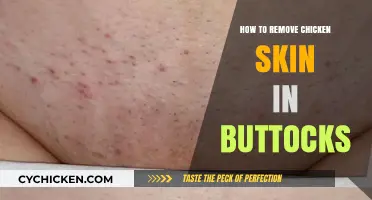Effective Tips to Remove Chicken Skin on Buttocks Smoothly