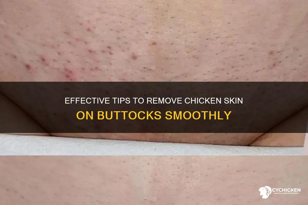 how to remove chicken skin in buttocks