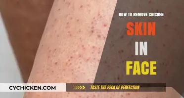 Effective Ways to Remove Chicken Skin on Your Face Naturally