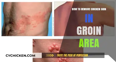 Effective Ways to Remove Chicken Skin in the Groin Area